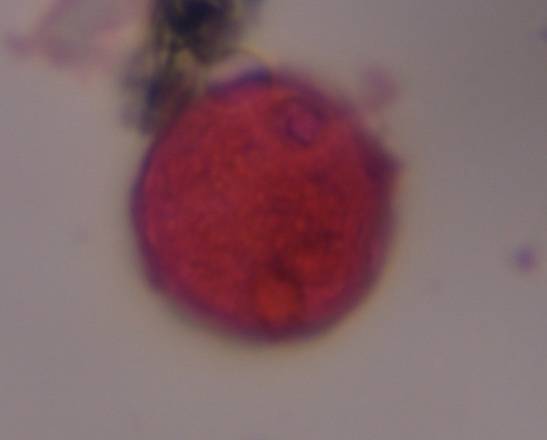 Microscope image of Poaceae — pollen (gallery) — verified by PollyMap