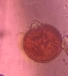 Microscope image of Grass — pollen (gallery) — verified by PollyMap