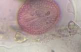 Microscope image of Olive — pollen (reference) — verified by PollyMap