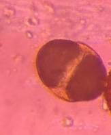 Microscope image of Pine — pollen (gallery) — verified by PollyMap