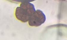 Microscope image of Stemphylium — mold (reference) — verified by PollyMap