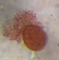Microscope image of Grass — pollen (gallery) — verified by PollyMap