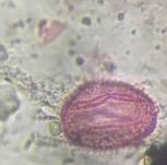 Microscope image of Olive — pollen (gallery) — verified by PollyMap