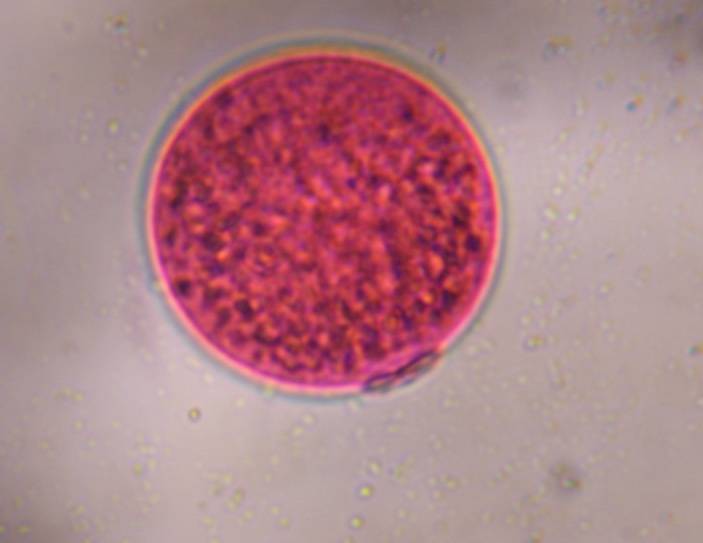 Microscope image of Poaceae — pollen (gallery) — verified by PollyMap