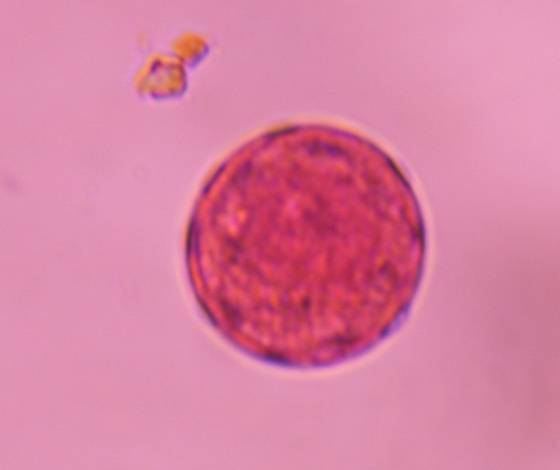 Microscope image of Chenopod — pollen (gallery) — verified by PollyMap
