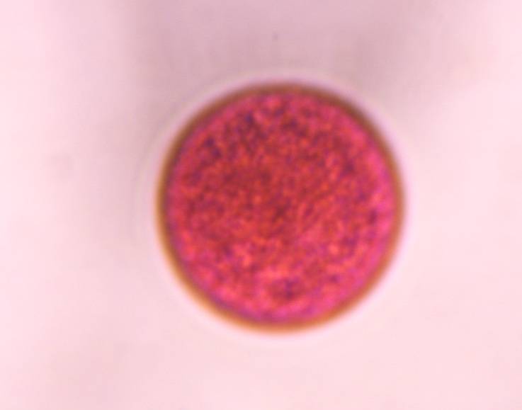 Microscope image of Poaceae — pollen (gallery) — verified by PollyMap