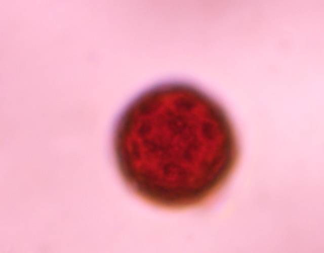 Microscope image of Chenopod — pollen (gallery) — verified by PollyMap