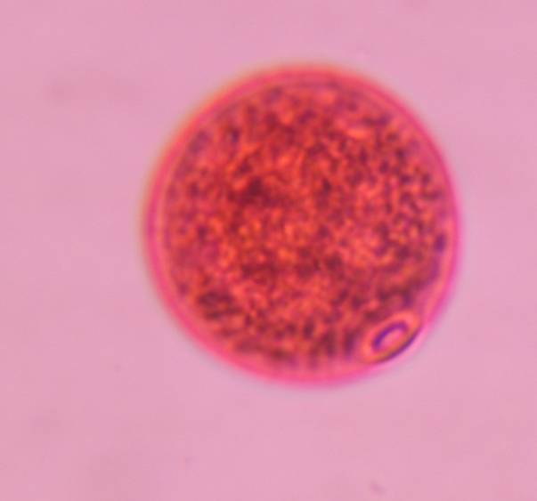 Microscope image of Poaceae — pollen (gallery) — verified by PollyMap