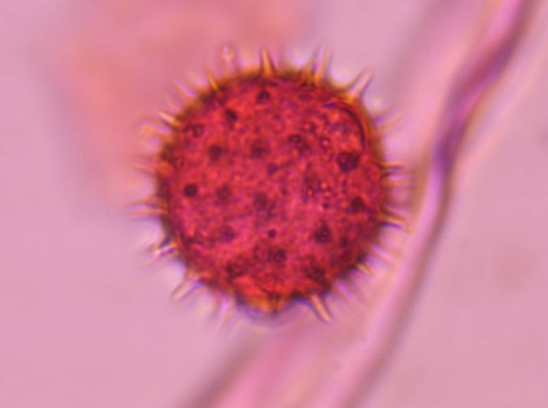 Microscope image of Asteraceae — pollen (gallery) — verified by PollyMap