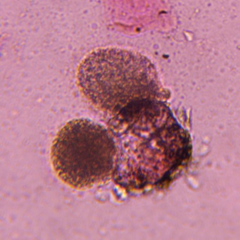 Microscope image of Pine — pollen (gallery) — verified by PollyMap