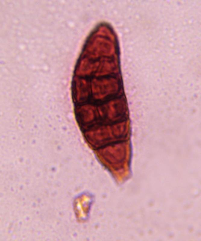 Microscope image of Alternaria — mold (gallery) — verified by PollyMap