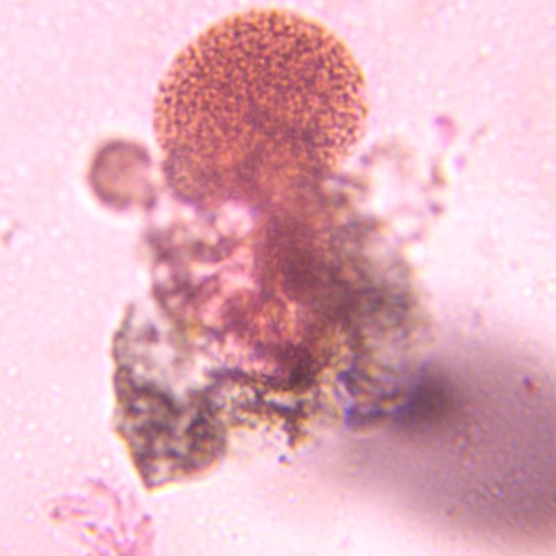 Microscope image of Pine — pollen (gallery) — verified by PollyMap