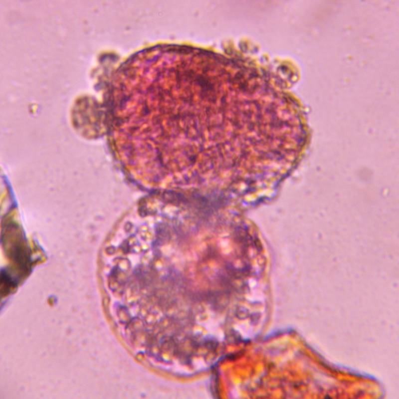 Microscope image of Pine — pollen (reference) — verified by PollyMap