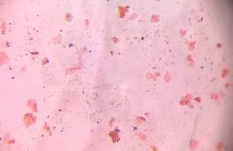 Microscope image of Squamous epithelial cells (Skin flakes) — dust (reference) — verified by PollyMap