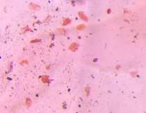 Microscope image of Skin squames / Dander — dust (reference) — verified by PollyMap