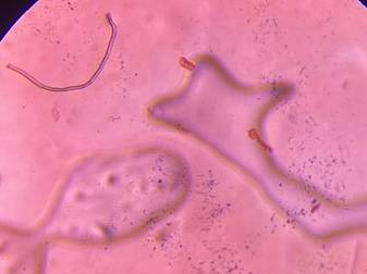 Microscope image of Synthetic or Cellulose Fiber — fiber (reference) — verified by PollyMap