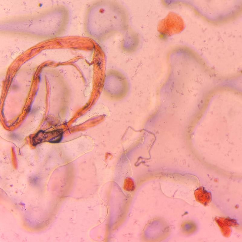 Microscope image of Textile — other (reference) — verified by PollyMap