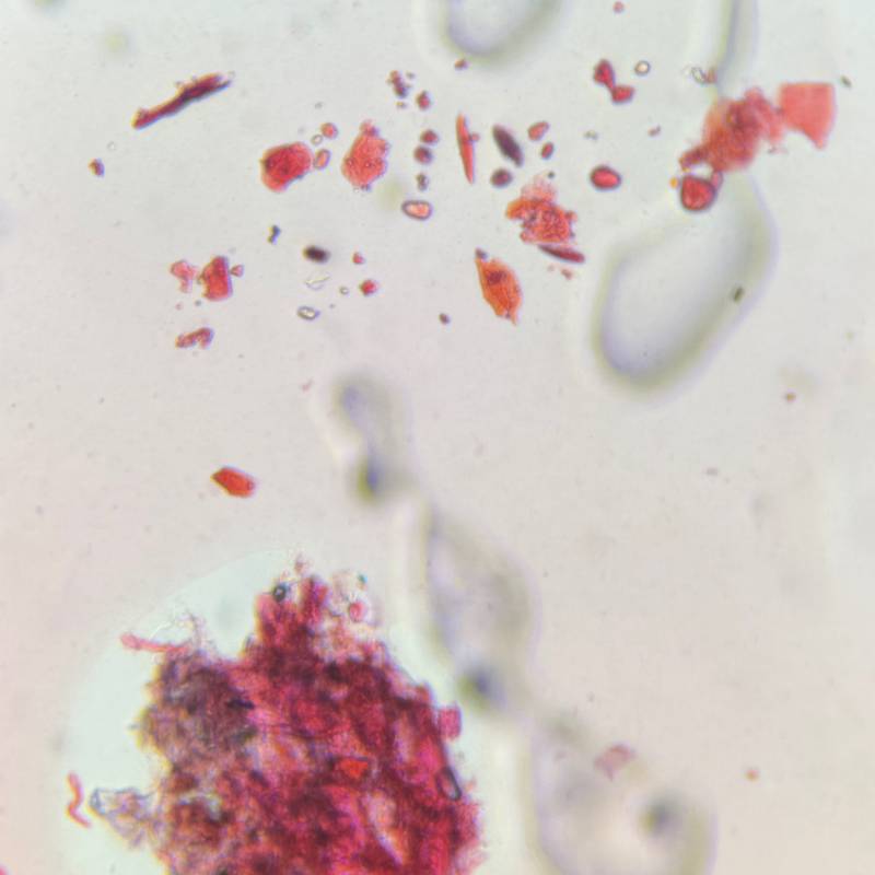 Microscope image of Skin cells — other (gallery) — verified by PollyMap