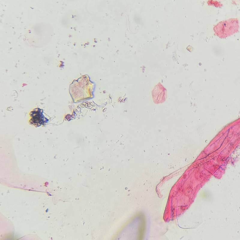 Microscope image of Debris — dust (reference) — verified by PollyMap