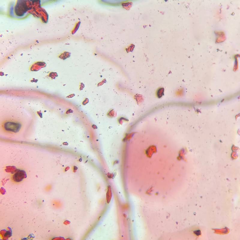 Microscope image of Skin cells — other (reference) — verified by PollyMap
