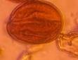 Microscope image of Oak — pollen (gallery) — verified by PollyMap