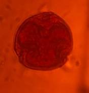 Microscope image of Oak — pollen (gallery) — verified by PollyMap
