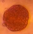 Microscope image of Elm — pollen (gallery) — verified by PollyMap