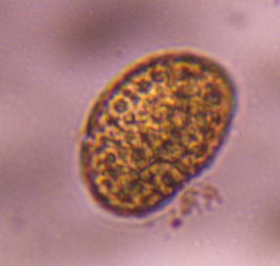 Microscope image of fern spore — pollen (reference) — verified by PollyMap