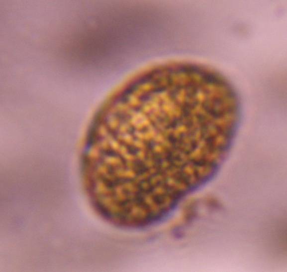 Microscope image of fern spore — pollen (gallery) — verified by PollyMap