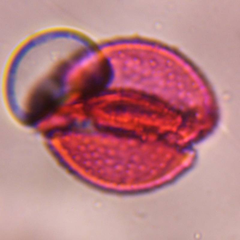 Microscope image of Pine — pollen (reference) — verified by PollyMap