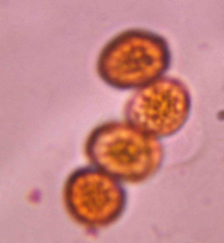 Microscope image of Smut — mold (reference) — verified by PollyMap