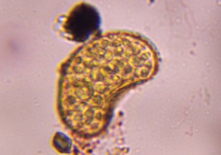 Microscope image of fern spore — pollen (gallery) — verified by PollyMap