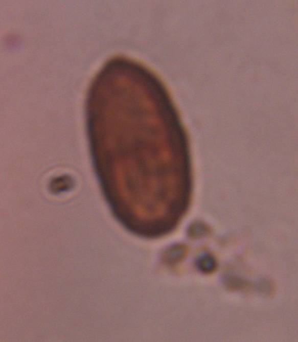 Microscope image of Unknown dematiaceous fungal spore — mold (reference) — verified by PollyMap