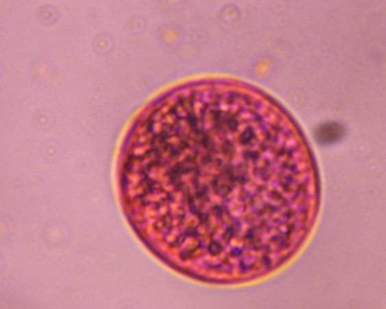 Microscope image of Grass — pollen (reference) — verified by PollyMap
