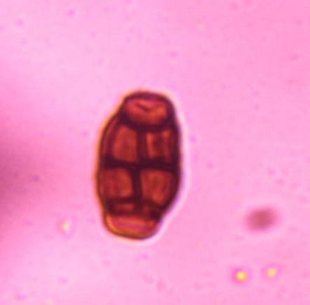Microscope image of Pithomyces — mold (reference) — verified by PollyMap