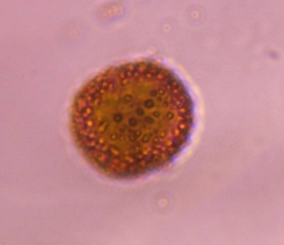 Microscope image of Smut — mold (gallery) — verified by PollyMap