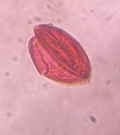 Microscope image of unidentified — pollen (reference) — verified by PollyMap