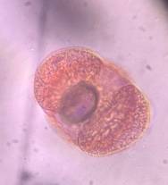 Microscope image of Pine — pollen (gallery) — verified by PollyMap