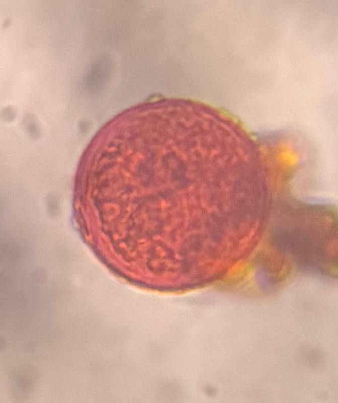 Microscope image of Poaceae — pollen (gallery) — verified by PollyMap