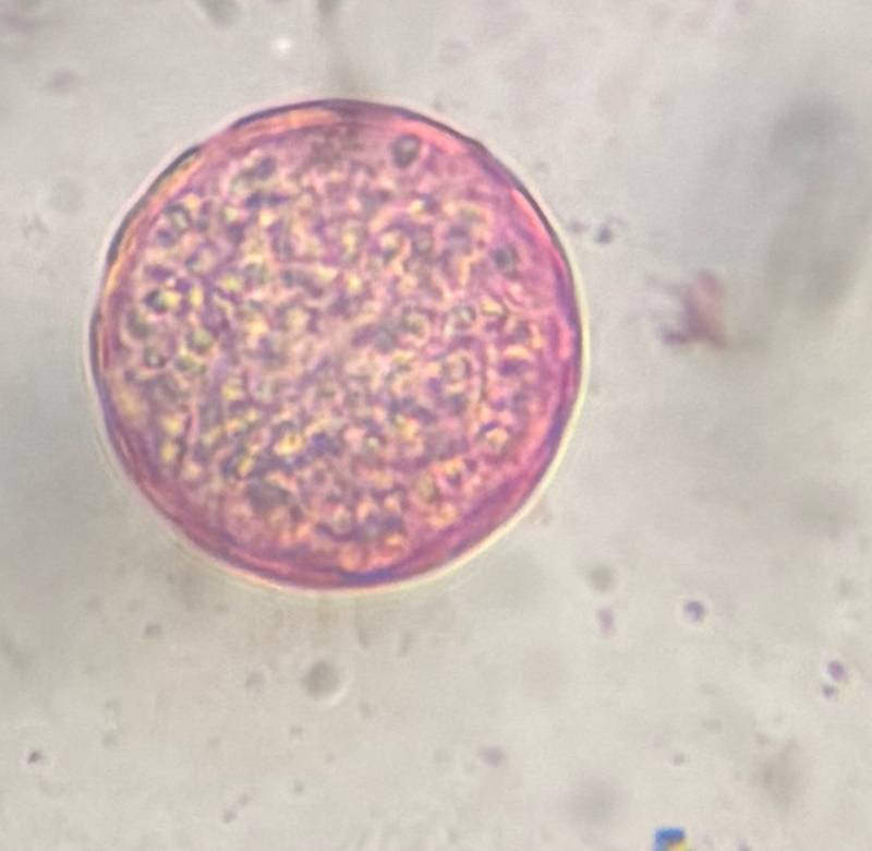 Microscope image of Chenopod — pollen (gallery) — verified by PollyMap