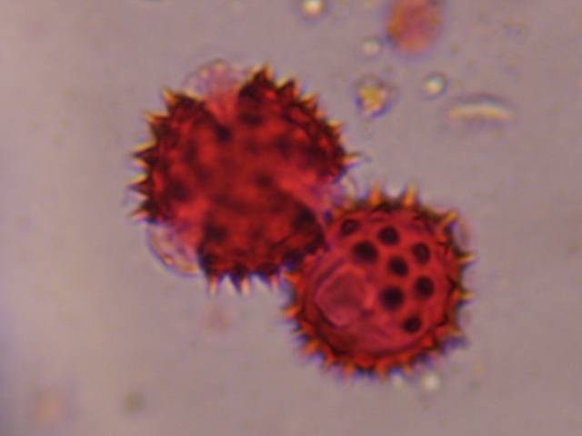 Microscope image of Asteraceae — pollen (gallery) — verified by PollyMap