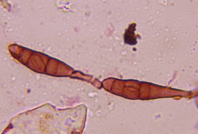Microscope image of Alternaria — mold (gallery) — verified by PollyMap