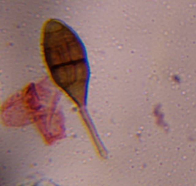 Microscope image of Alternaria — mold (gallery) — verified by PollyMap
