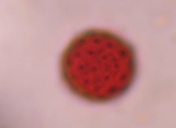 Microscope image of Chenopod — pollen (gallery) — verified by PollyMap