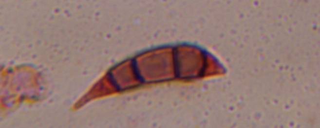Microscope image of Curvularia — mold (gallery) — verified by PollyMap