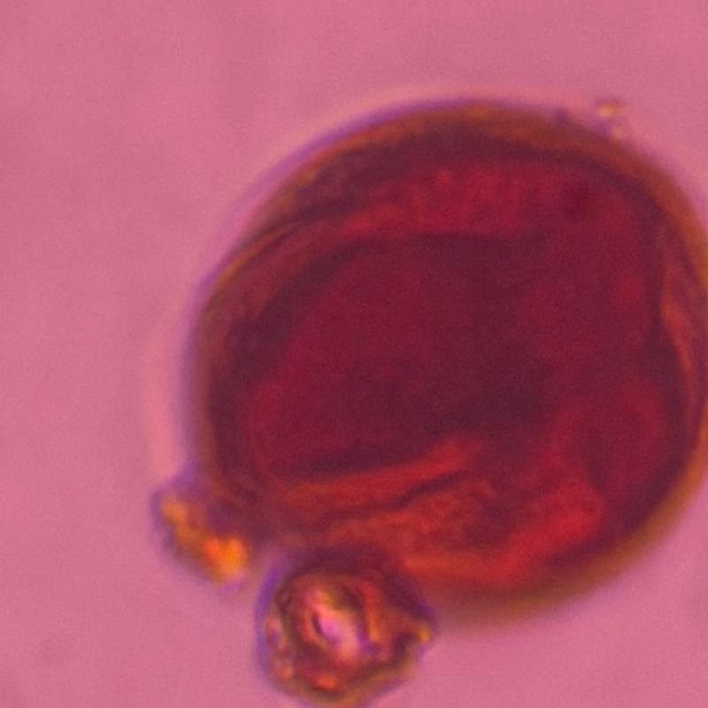 Microscope image of Oak — pollen (gallery) — verified by PollyMap