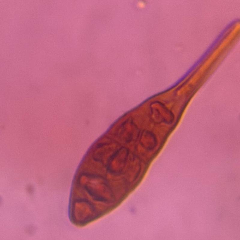 Microscope image of Alternaria — mold (gallery) — verified by PollyMap