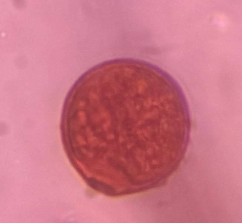 Microscope image of Grass — pollen (gallery) — verified by PollyMap