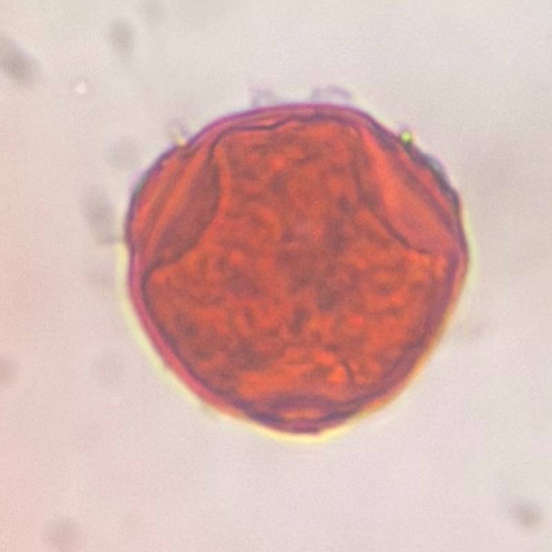 Microscope image of Hackberry — pollen (gallery) — verified by PollyMap