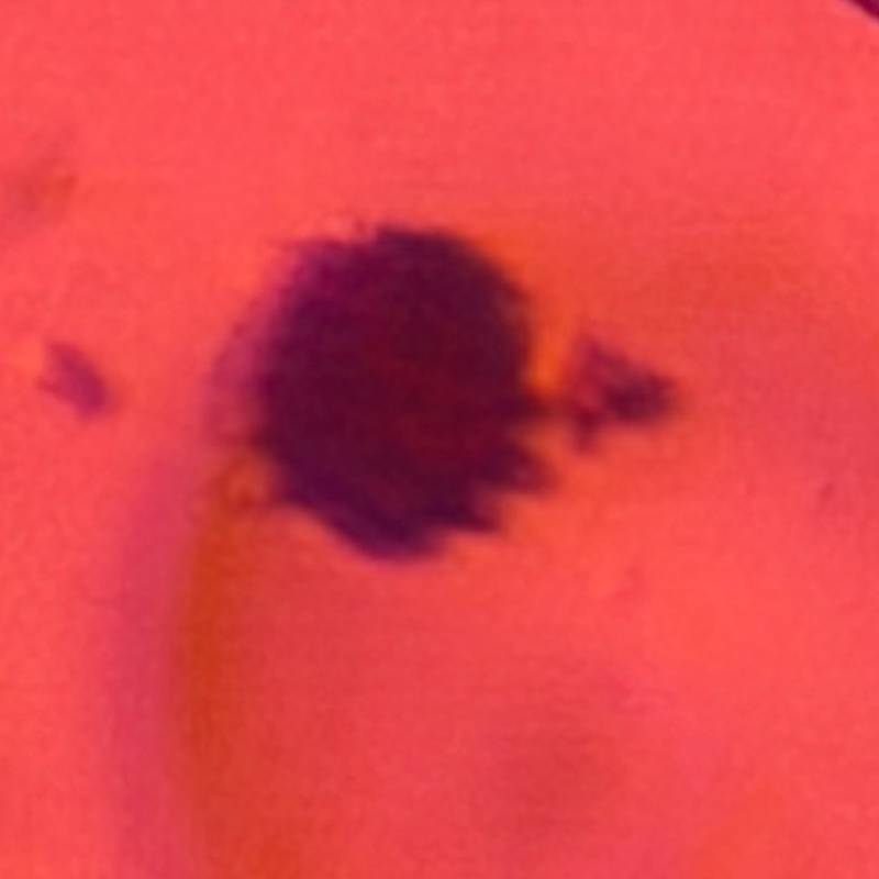 Microscope image of Asteraceae — pollen (gallery) — verified by PollyMap
